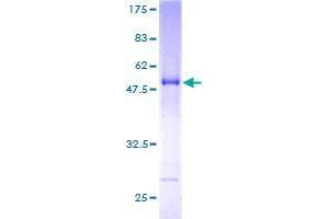 SNX27 Protein (AA 1-219) (GST tag)