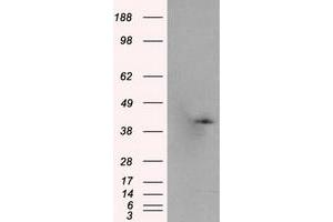 Western Blotting (WB) image for anti-Pleckstrin (PLEK) antibody (ABIN1500272)