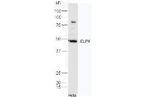 HeLa cell lysates probed with Rabbit Anti-ELP4 Polyclonal Antibody, Unconjugated (ABIN2559624) at 1:300 in 4˚C. (ELP4 antibody  (AA 321-424))