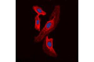 Immunofluorescent analysis of FHIT staining in HEK293T cells. (FHIT antibody  (Center))