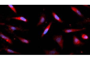 Immunofluorescence (IF) image for anti-AlkB, Alkylation Repair Homolog 3 (ALKBH3) (AA 1-286) antibody (APC) (ABIN5565112) (ALKBH3 antibody  (AA 1-286) (APC))