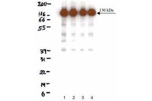 Western blot analysis of N-Cadherin on HeLa lysate. (N-Cadherin antibody  (AA 802-819))