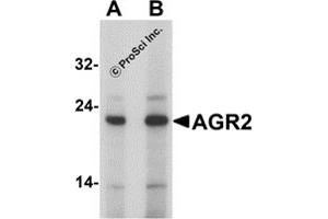 Western Blotting (WB) image for anti-Anterior Gradient Homolog 2 (Xenopus Laevis) (AGR2) (N-Term) antibody (ABIN1077447) (AGR2 antibody  (N-Term))
