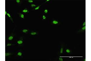 Immunofluorescence of purified MaxPab antibody to CIRBP on HeLa cell. (CIRBP antibody  (AA 1-172))
