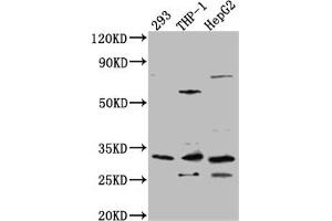 Western Blot Positive WB detected in: 293 whole cell lysate, THP-1 whole cell lysate, HepG2 whole cell lysate All lanes: COMT Antibody at 1:1000 Secondary Goat polyclonal to rabbit IgG at 1/50000 dilution Predicted band size: 31, 25 kDa Observed band size: 31 kDa (Recombinant COMT antibody)