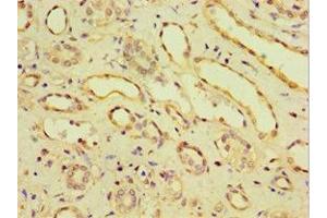Immunohistochemistry of paraffin-embedded human kidney tissue using ABIN7146201 at dilution of 1:100 (OB Cadherin antibody  (AA 637-796))