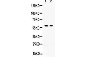 Western blot analysis of AIRE using anti- AIRE antibody . (AIRE antibody  (AA 1-120))