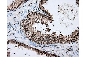 Immunohistochemical staining of paraffin-embedded liver tissue using anti-ERCC1 mouse monoclonal antibody. (ERCC1 antibody)