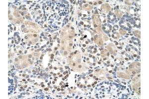 PSAT1 antibody was used for immunohistochemistry at a concentration of 4-8 ug/ml to stain Epithelial cells of renal tubule (arrows) in Human Kidney.