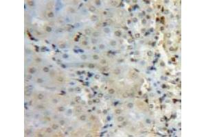 Used in DAB staining on fromalin fixed paraffin-embedded Kidney tissue (SUV420H2/KMT5C antibody  (AA 2-279))