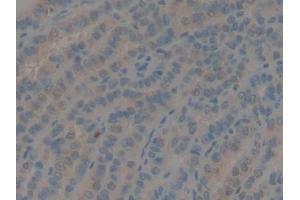 IHC-P analysis of Human Thyroid Tissue, with DAB staining.