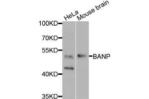 Western blot analysis of extracts of HeLa and mouse brain cells, using BANP antibody.