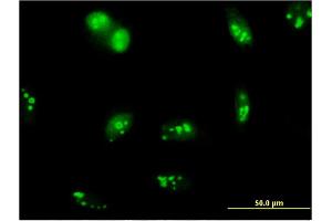 Immunofluorescence of monoclonal antibody to SENP5 on HeLa cell. (SENP5 antibody  (AA 2-109))