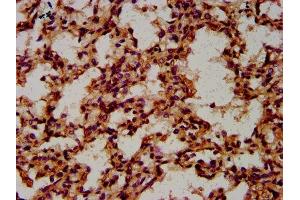 IHC image of ABIN7148531 diluted at 1:600 and staining in paraffin-embedded human lung tissue performed on a Leica BondTM system. (CPNE8 antibody  (AA 349-498))