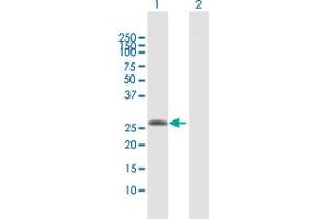 Western Blot analysis of SLA2 expression in transfected 293T cell line by SLA2 MaxPab polyclonal antibody. (SLAP2 antibody  (AA 1-261))