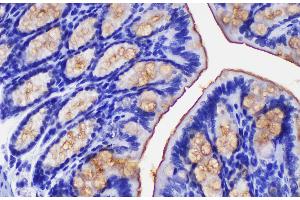 Immunohistochemistry of paraffin-embedded Mouse colon using Ceacam1 Polycloanl Antibody at dilution of 1:200 (CEACAM1 antibody)