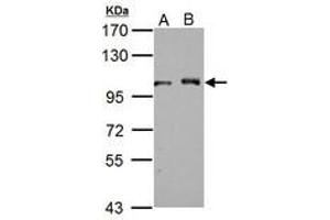 Image no. 2 for anti-DEAD (Asp-Glu-Ala-Asp) Box Polypeptide 23 (DDX23) (AA 136-350) antibody (ABIN1501884) (DDX23 antibody  (AA 136-350))