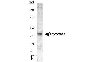 Image no. 2 for anti-Cytochrome P450, Family 19, Subfamily A, Polypeptide 1 (CYP19A1) (C-Term) antibody (ABIN363492) (Aromatase antibody  (C-Term))