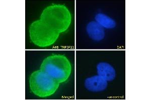 ABIN6391341 Immunofluorescence analysis of paraformaldehyde fixed MCF7 cells, permeabilized with 0. (RANKL antibody  (Internal Region))