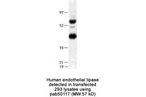 Image no. 2 for anti-Lipase, Endothelial (LIPG) (N-Term) antibody (ABIN363426) (LIPG antibody  (N-Term))