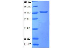 SCAMP3 Protein (AA 2-170, partial) (GST tag)