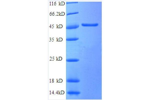 SCAMP3 Protein (AA 2-170, partial) (GST tag)