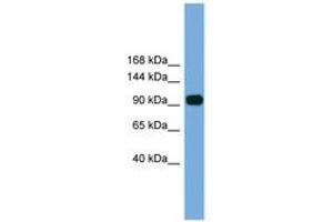 Image no. 1 for anti-Poly (ADP-Ribose) Polymerase Family, Member 8 (PARP8) (AA 21-70) antibody (ABIN6746207) (PARP8 antibody  (AA 21-70))