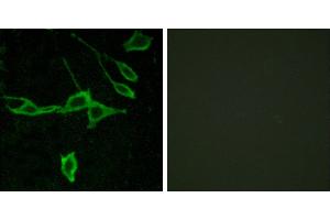 Peptide - +Western blot analysis of extracts from COLO205 cells, using HRH1 antibody. (HRH1 antibody  (Internal Region))