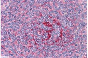 Human Spleen: Formalin-Fixed, Paraffin-Embedded (FFPE) (GABPB1 antibody  (AA 198-210))