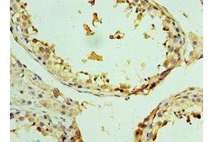 Immunohistochemistry of paraffin-embedded human testis tissue using ABIN7176096 at dilution of 1:100