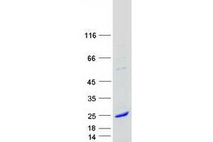Validation with Western Blot