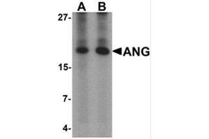 Western blot analysis of ANG in rat liver tissue lysate with Ang Antibody  at (A) 1 and (B) 2 μg/mL. (ANG antibody  (Middle Region))