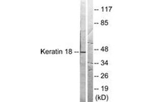 Western blot analysis of extracts from HeLa cells, treated with UV 5', using Keratin 18 (Ab-33) Antibody. (Cytokeratin 18 antibody  (AA 1-50))