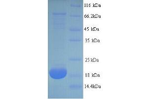 SDS-PAGE (SDS) image for Major Urinary Protein 2 (MUP2) (AA 19-180) protein (ABIN5714024) (MUP2 Protein (AA 19-180))