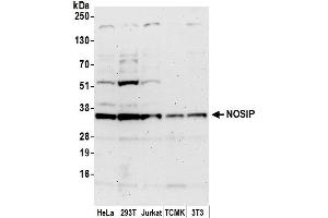 anti-Nitric Oxide Synthase Interacting Protein (NOSIP) (AA 1-50) antibody