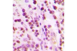 Immunohistochemical analysis of Ku70 staining in human tonsil formalin fixed paraffin embedded tissue section. (XRCC6 antibody  (N-Term))