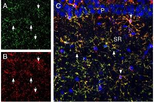 Multiplex staining of CX3CR1 and CD11b in rat hippocampus. (CX3CR1 antibody  (Extracellular, N-Term))