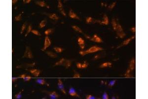 Immunofluorescence analysis of L929 cells using CSF2 Polyclonal Antibody at dilution of 1:100. (GM-CSF antibody)