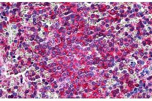 Human Spleen: Formalin-Fixed, Paraffin-Embedded (FFPE) (LCP1 antibody  (Headpiece Region))