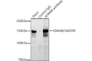 Immunoprecipitation analysis of 300 μg extracts of HCT116 cells using 3 μg KDM4B/JMJD2B antibody (ABIN7268329). (KDM4B antibody)