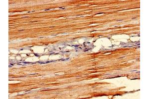 Immunohistochemistry of paraffin-embedded human skeletal muscle tissue using ABIN7160449 at dilution of 1:100