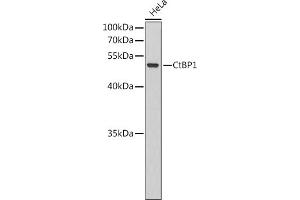 Western blot analysis of extracts of HeLa cells, using CtBP1 antibody (ABIN6127531, ABIN6139177, ABIN6139178 and ABIN6220177). (CTBP1 antibody  (AA 20-250))