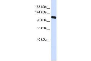 KIF5C antibody used at 1 ug/ml to detect target protein. (KIF5C antibody  (N-Term))