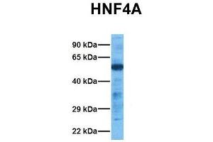 Host:  Rabbit  Target Name:  HNF4A  Sample Tissue:  Human Lung Tumor  Antibody Dilution:  1.