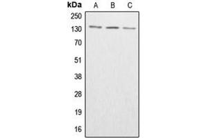Western blot analysis of ABL1/2 (pY393/439) expression in HeLa colchicine-treated (A), SP2/0 colchicine-treated (B), H9C2 colchicine-treated (C) whole cell lysates. (ABL1/2 antibody  (C-Term, pTyr393, pTyr439))