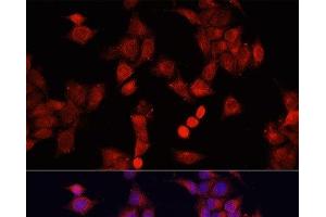 Immunofluorescence analysis of HeLa cells using SMAD2 Polyclonal Antibody at dilution of 1:100. (SMAD2 antibody)