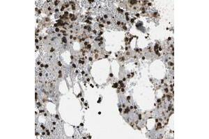 Immunohistochemical staining of human bone marrow with CACHD1 polyclonal antibody  shows strong cytoplasmic positivity in subsets of bone marrow poietic cells at 1:1000-1:2500 dilution. (CACHD1 antibody)