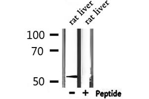 Western blot analysis of extracts from mouse liver, using MeCP2 antibody.