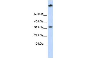 WB Suggested Anti-SCP2 Antibody Titration: 0. (SCP2 antibody  (Middle Region))