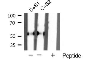 Western blot analysis of extracts of various smaple,using Smad2 Antibody.